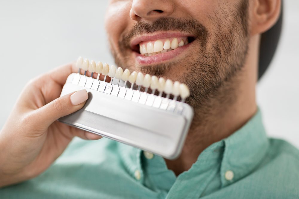 dental veneers in clovis